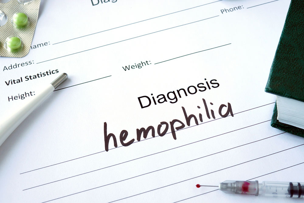 Risk Factors and Prevention Tips for Hemophilia